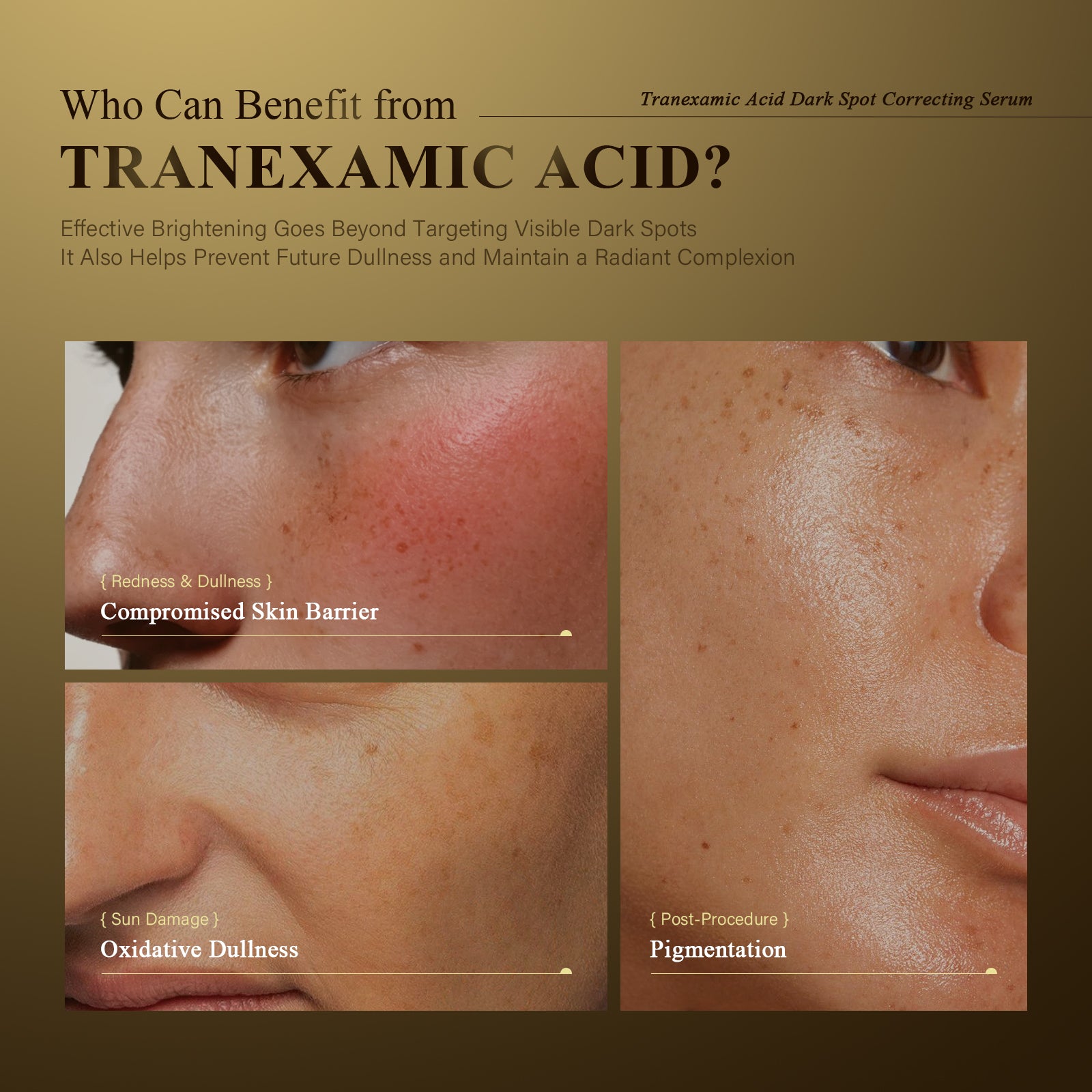 DR.LIGEDO TRANEXAMICAID DARK SPOT CORRECTING SERUM